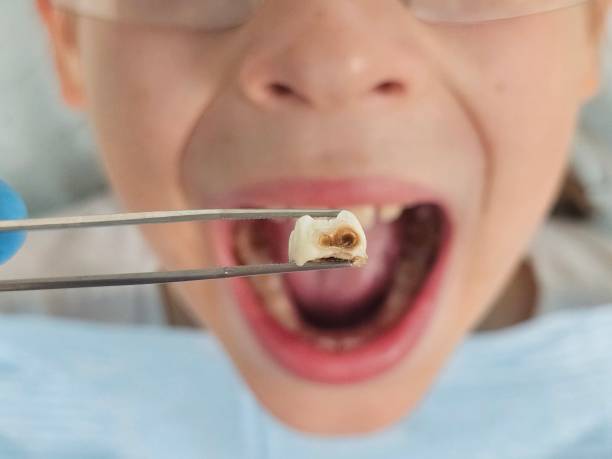 Best Emergency Dentist for Knocked-Out Tooth in Eagleville, PA